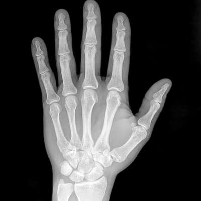 Carpal & Tarsal Bones