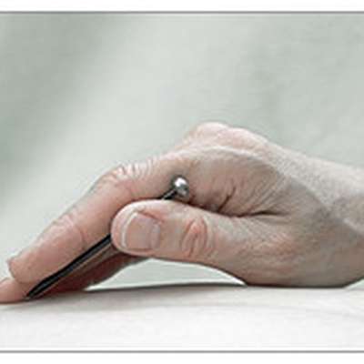 Acupuncture points (upper extremities)
