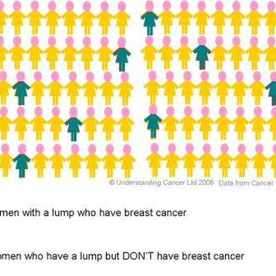 Breast Lumps